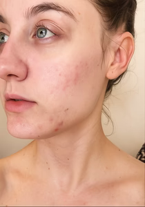 Before - “My coworker asked why I was glowing… I had to put her on!”