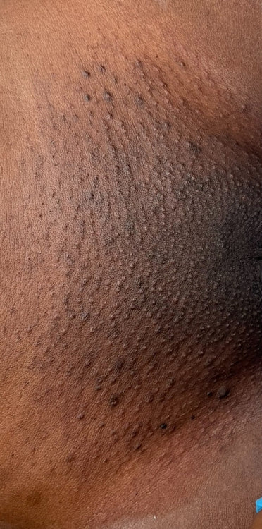 Before - Worth every penny