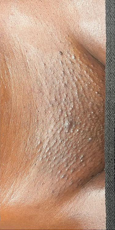 After - Worth every penny