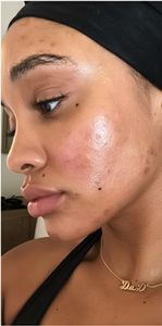 Before - “Saw it on Instagram… didn’t expect it to work THIS well”