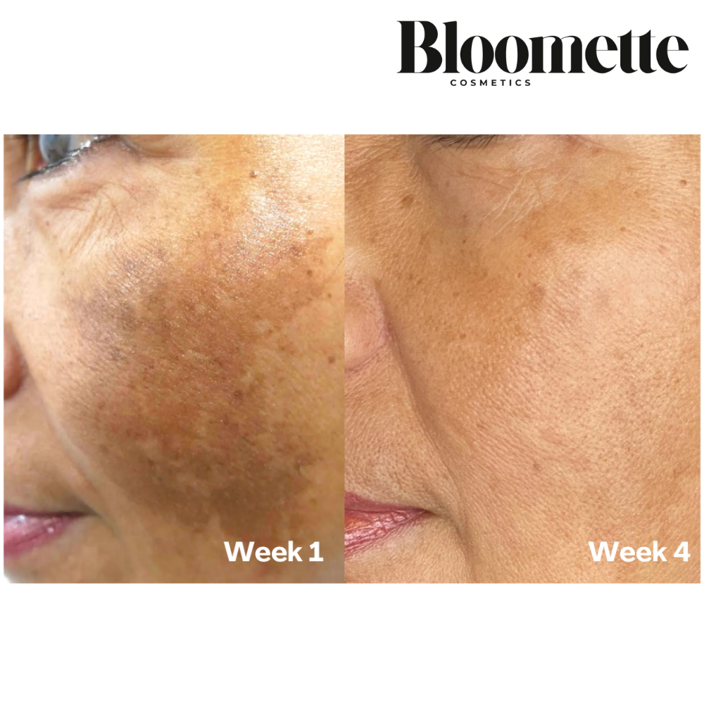 Kojic Acid Turmeric Vita Brightening Body Wash