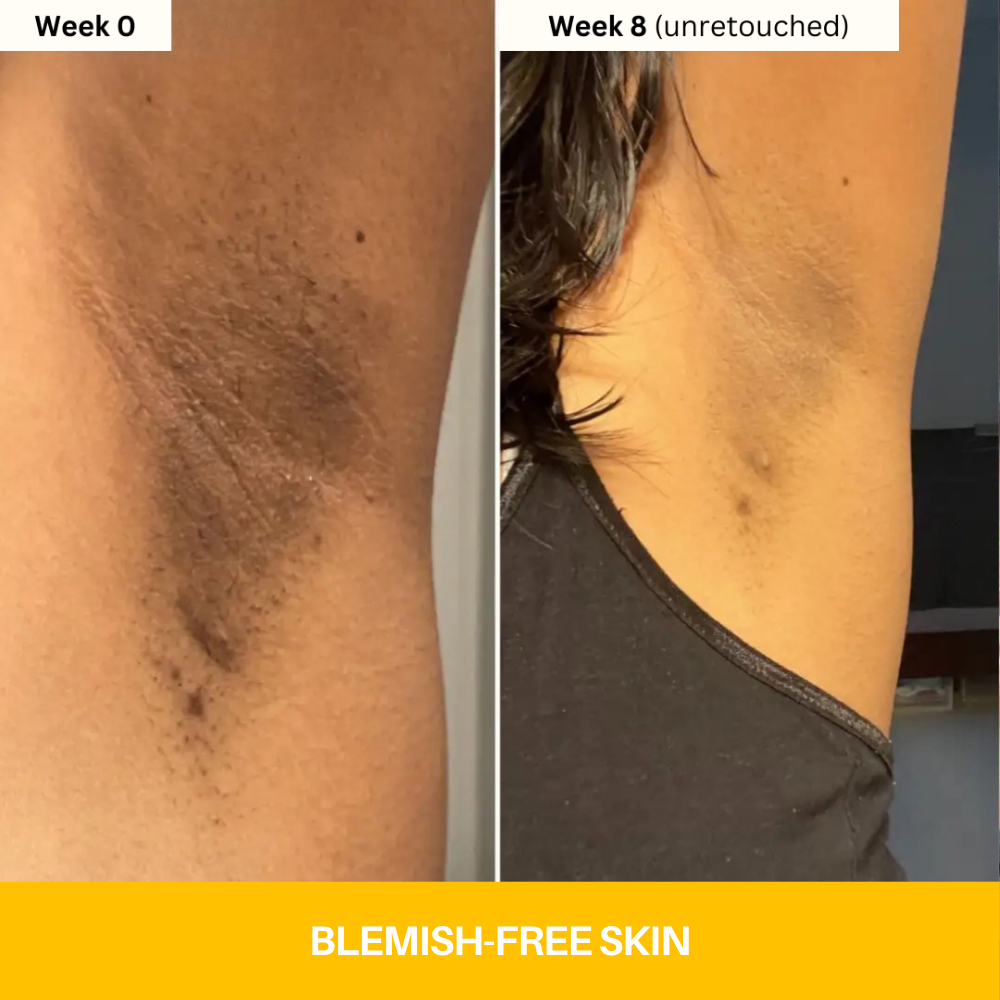 Kojic Acid Turmeric Vita Brightening Body Wash