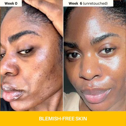 Kojic Acid Turmeric Vita Brightening Body Wash