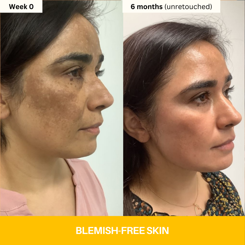 Kojic Acid Turmeric Vita Brightening Body Wash