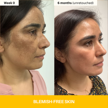 Kojic Acid Turmeric Vita Brightening Body Wash