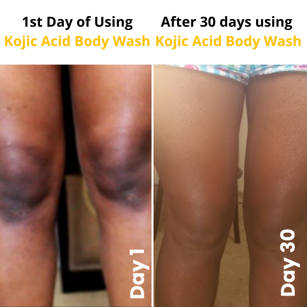 Kojic Acid Turmeric Vita Brightening Body Wash