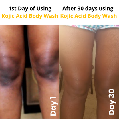 Kojic Acid Turmeric Vita Brightening Body Wash