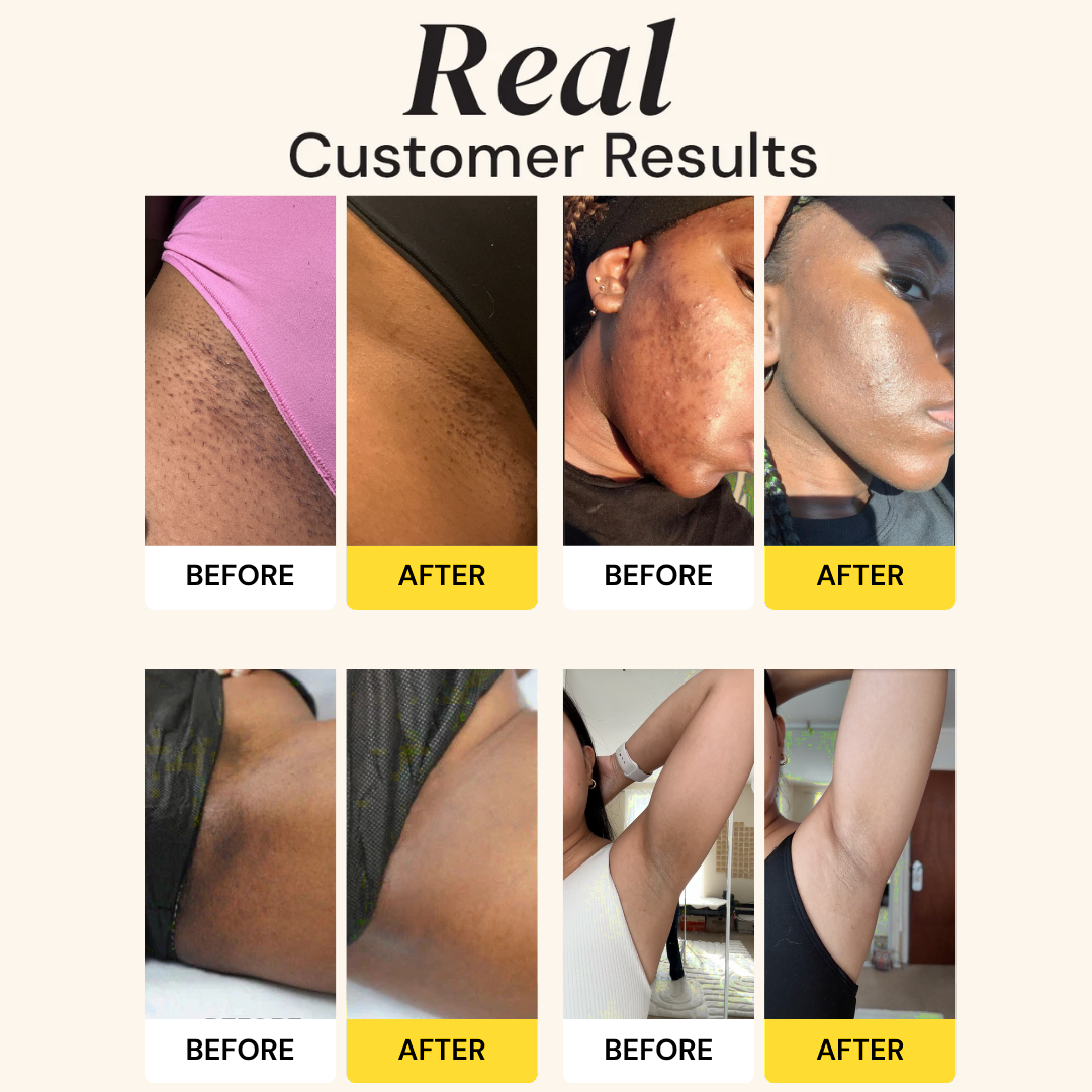 Kojic Acid Turmeric Vita Brightening Body Wash