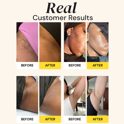 Kojic Acid Turmeric Vita Brightening Body Wash