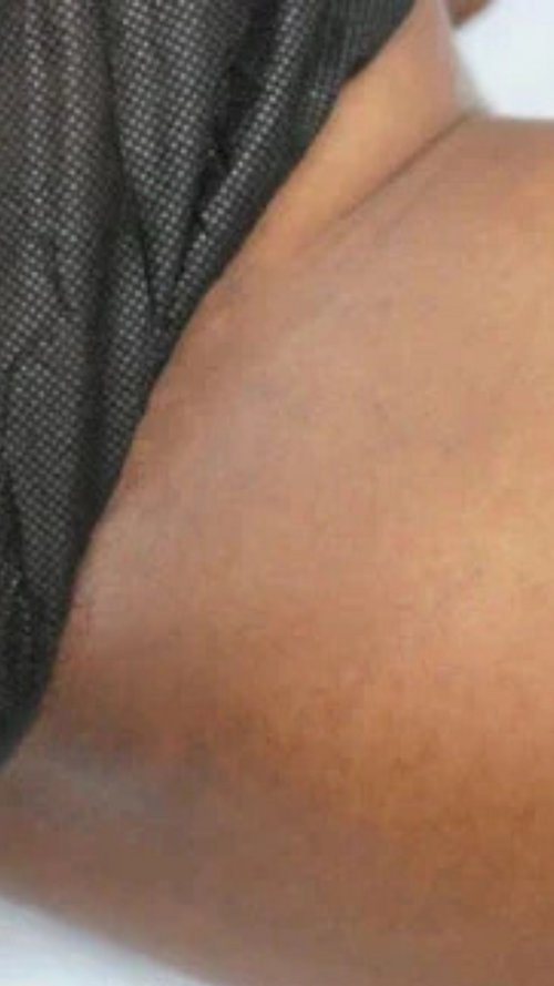 After - Finally confident again!