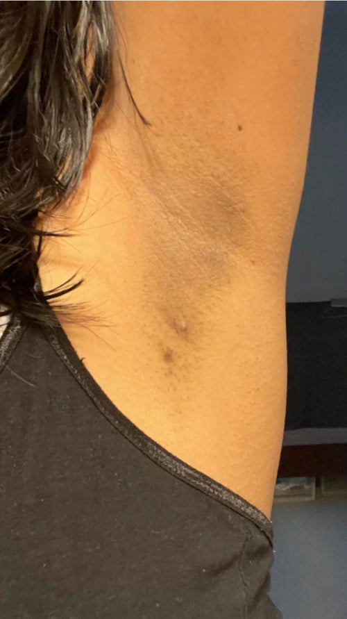 After - I stopped hiding my underarms!