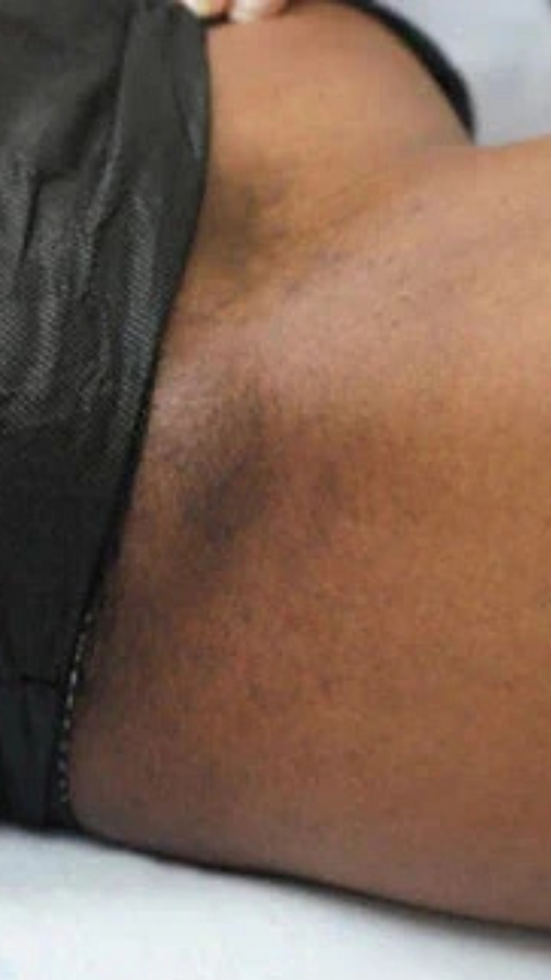 Before - Finally confident again!