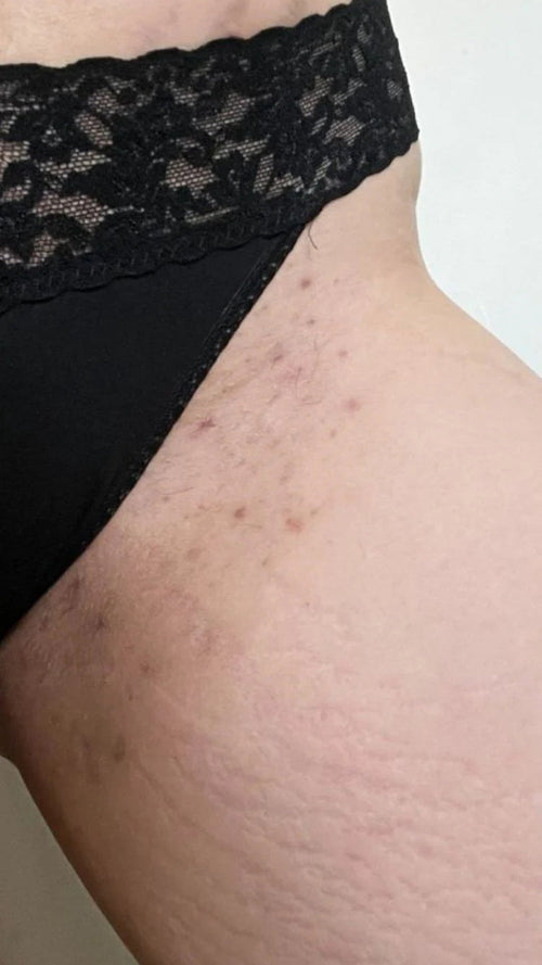 Before - I'm literally obsessed!!