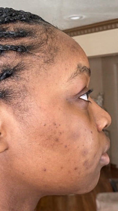 Before - It gave me back my glow