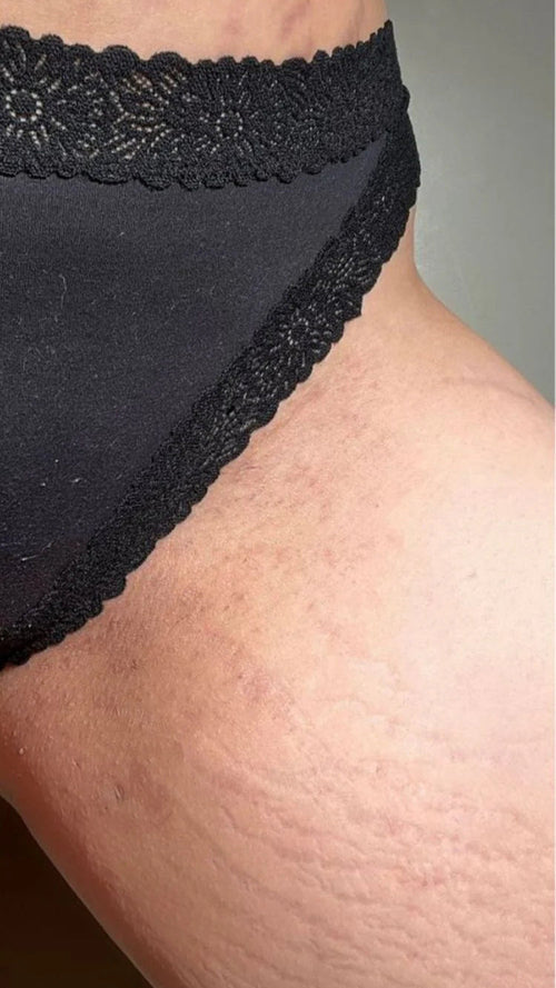 After - I'm literally obsessed!!