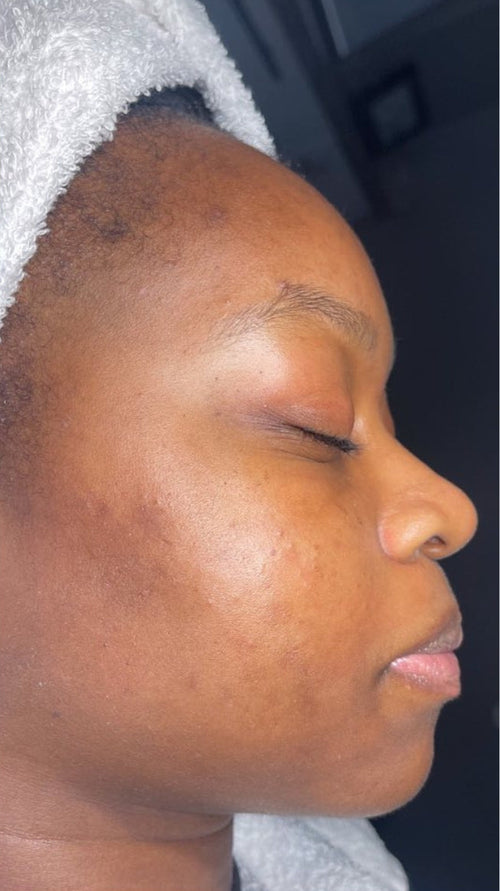 After - It gave me back my glow